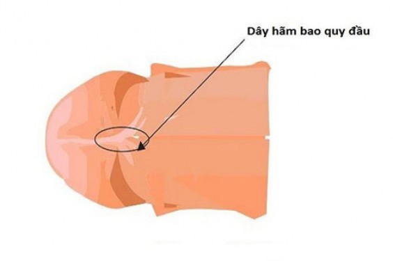 Chi phí cắt dây hãm bao quy đầu bao nhiêu tiền, cắt ở đâu tốt?