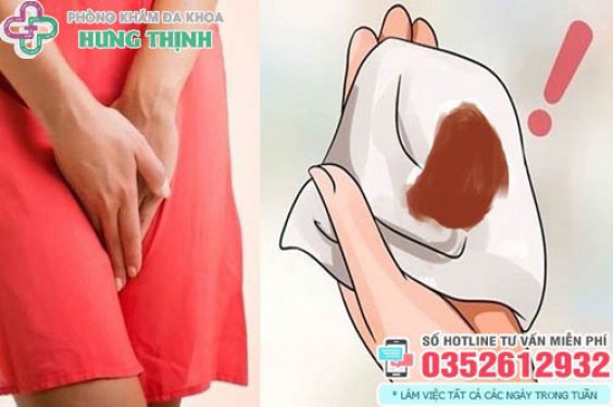 Ra khí hư màu nâu trước kỳ kinh nguyệt có sao không?