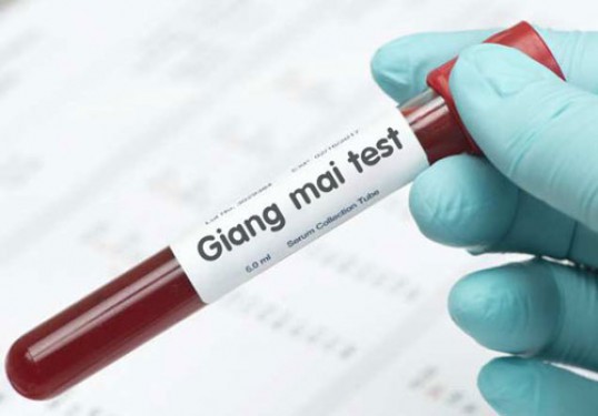 Chi phí xét nghiệm giang mai hết bao nhiêu tiền giá chữa bệnh