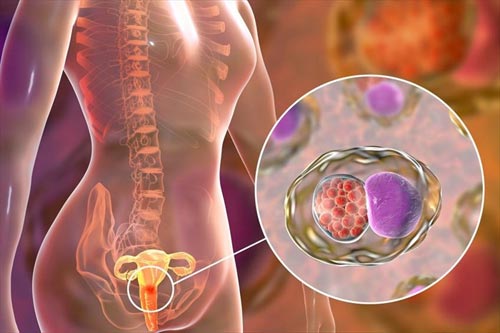 Bệnh lậu là gì? Triệu chứng, chẩn đoán và cách điều trị