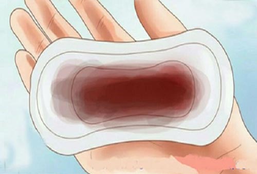 Cách chữa vùng kín ra dịch màu nâu đen không mùi