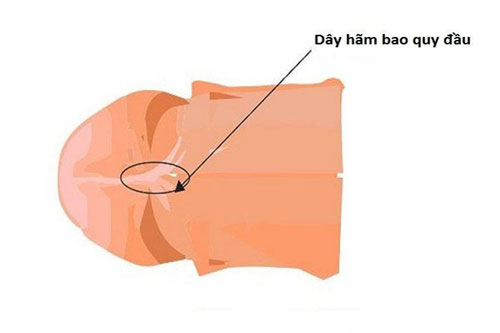 Dây hãm bao quy đầu là gì?