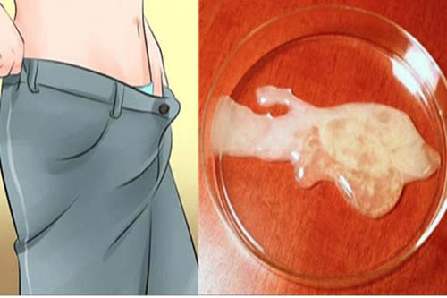 Tinh dịch đổi màu vàng là dấu hiệu của bệnh gì?