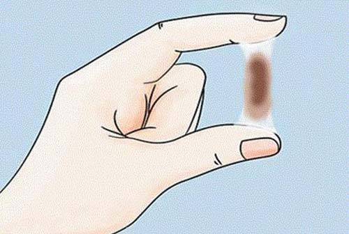 Vùng kín ra dịch màu nâu đen không mùi